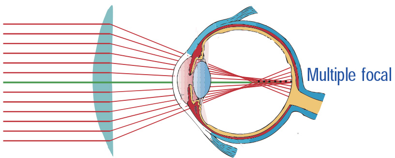 Peritus ClearForm SV